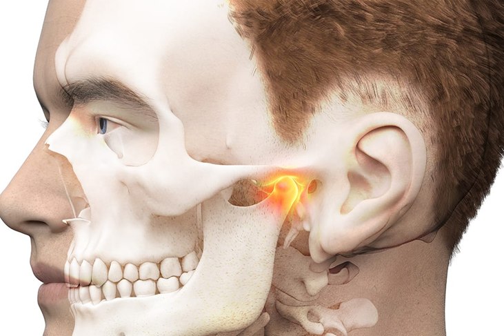 Articulación temporomandibular ATM - anatomía con punto de inflamación